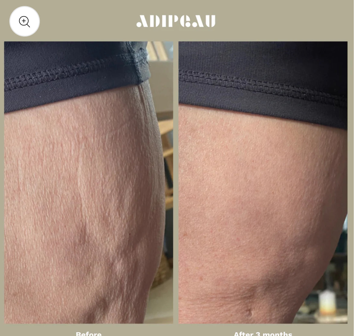 Adipeau Strong Body Gel