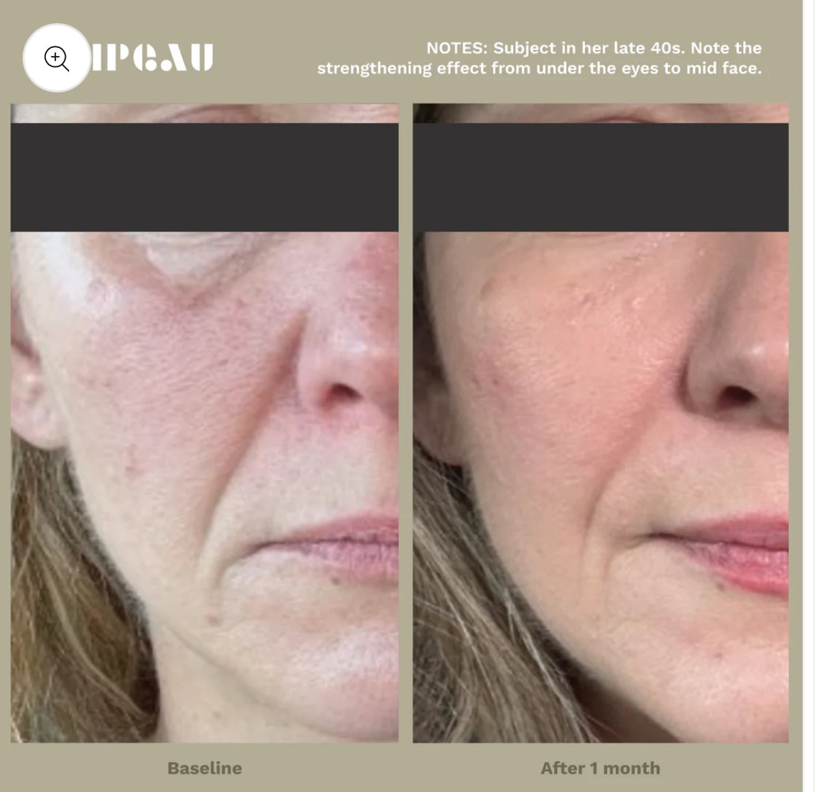 Adipeau Strong Body Gel