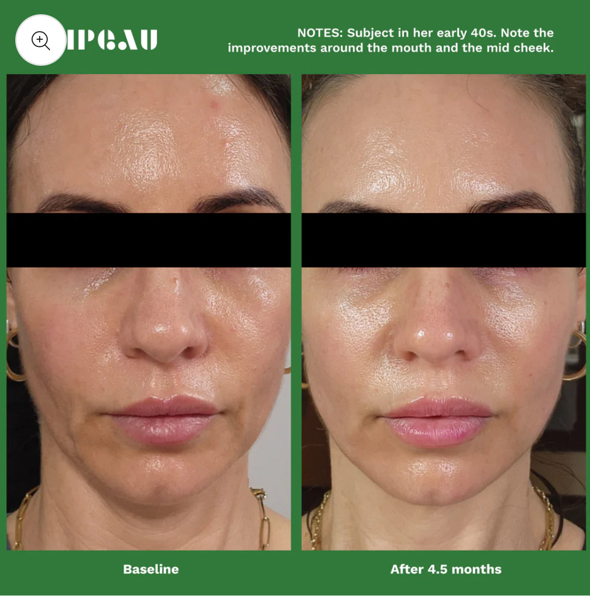 Adipeau Active Face Cream